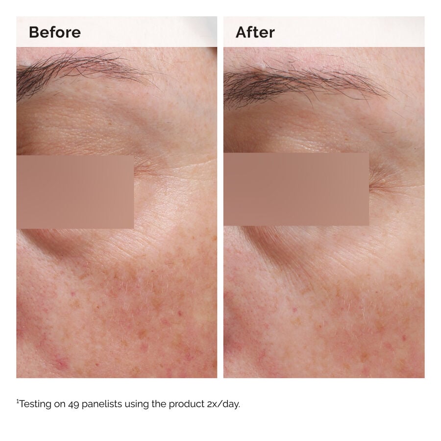 niacinamide-5-face-and-body-emulsion-y8 2024-08-23-ORD-Nia-5pct-Face-Body-B-A-Elasticity-Global-02-1x1.jpg