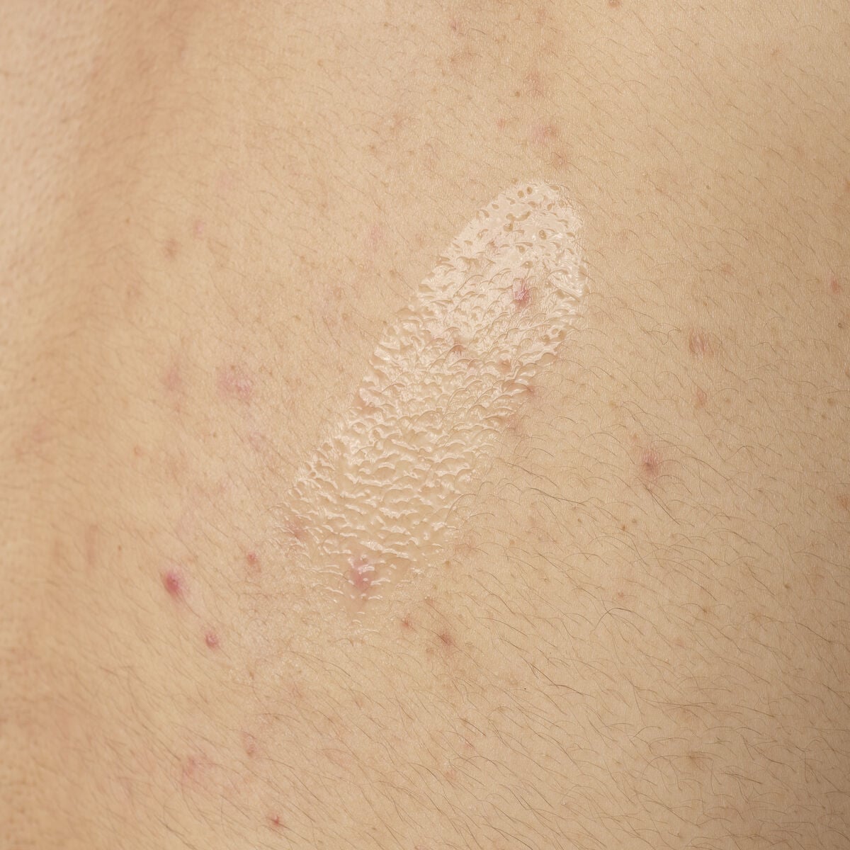 salicylic-acid-0-5-body-serum-y2 ORD-salicylic-acid-05-body-240ml-application.jpg