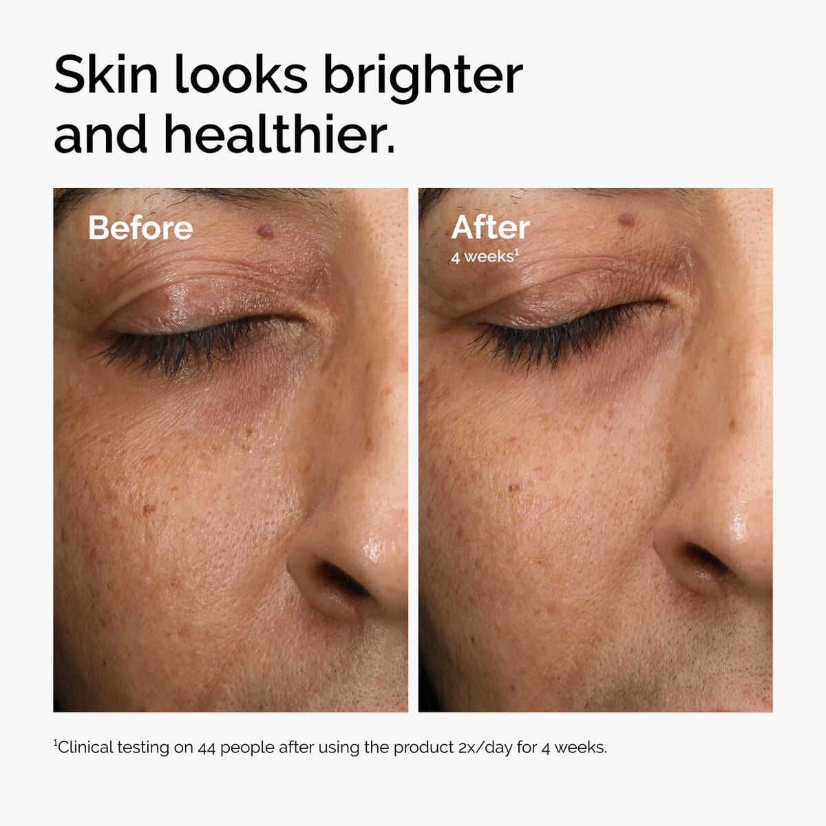 multi-antioxidant-radiance-serum-y9 ord-mars-before-after-healthy.jpg