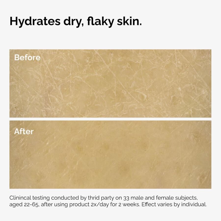 the-body-care-collection-u6 ord-natural-moisturizing-factors-inulin-body-before-after-graphic-02.jpg