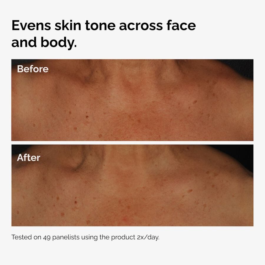 the-body-care-collection-u6 ord-niacinamide-face-body-serum-before-after-even-tone-graphic.jpg